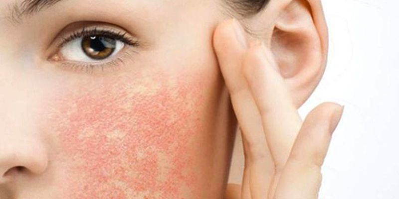 Đắp mặt nạ rẻ tiền, kém chất lượng gây kích ứng da